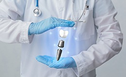 Dental implant in Gainesville