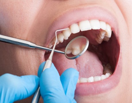 Closeup of dentist using tools to examine a patient's teeth