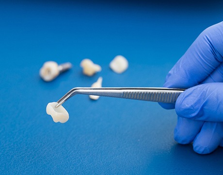 Dentist holding dental crown with tweezers