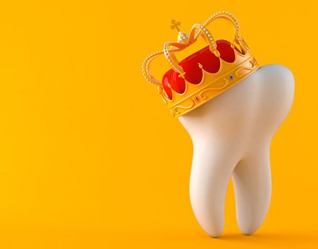Tooth wearing crown