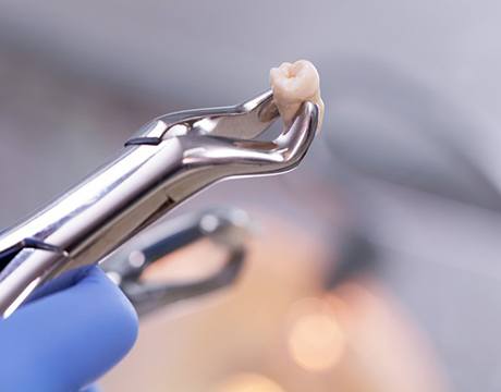 dentist in Gainesville holding an extracted tooth with a dental instrument 
