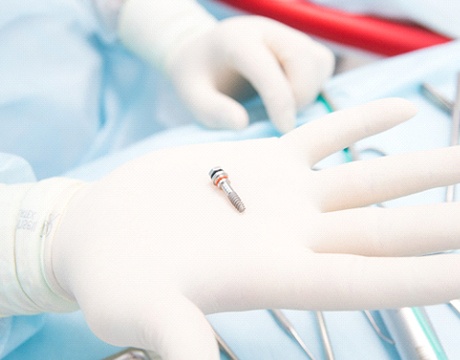 Close-up of hand in white glove holding dental implant