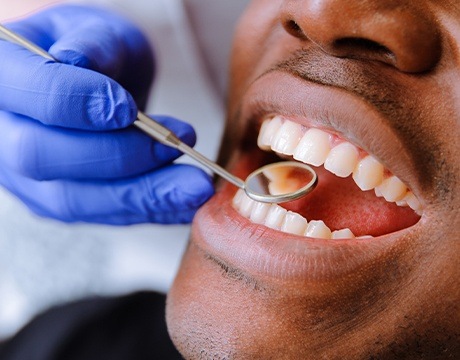 Closeup of patient receiving dental treatment