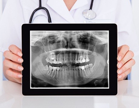 Digital x-rays on tablet computer