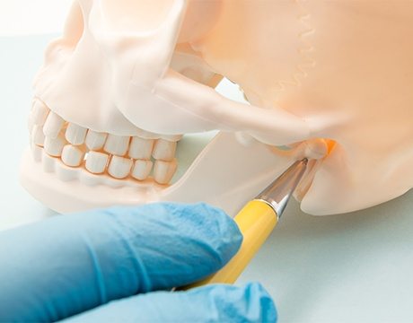 Model of jaw and skull