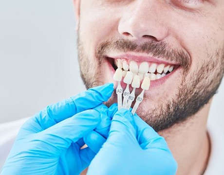 dentist holding veneers up to a patient’s teeth 