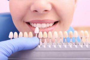 A color scale being held to a woman’s smile to determine the shade of her teeth