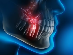 Model of a severe toothache