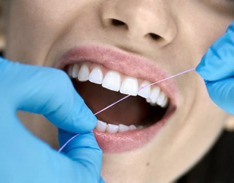 Dental hygienist using floss to clean between each tooth